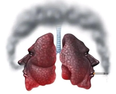 戒烟后肺部恢复的旅程，10年烟龄者的希望之路一手货源 - 5 - 635香烟网