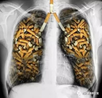 戒烟后多久肺部才能彻底干净图：戒烟后多久肺部才能彻底干净！