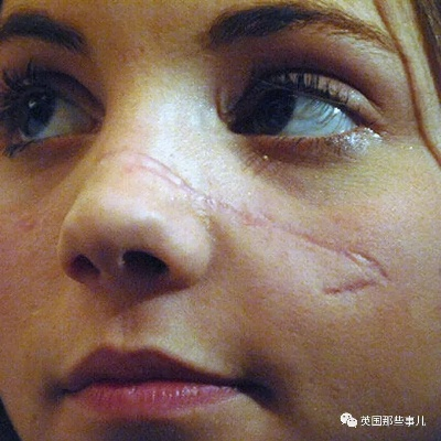我在美国疤顿的震撼经历:一座城市的伤痕与重生 我在美国疤顿的震撼经历:一座城市的伤痕与重生