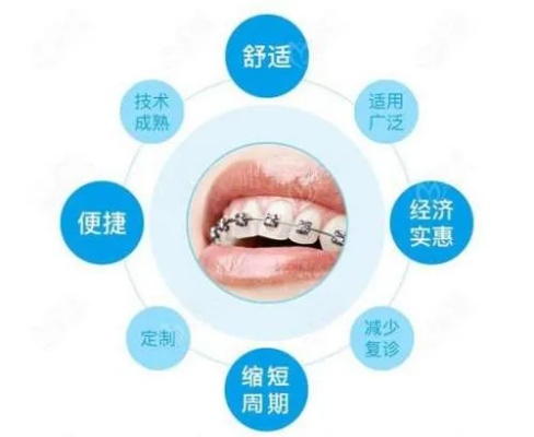 临沂市儿童牙科正畸的长尾关键词有哪些 临沂市儿童牙科正畸的长尾关键词有哪些