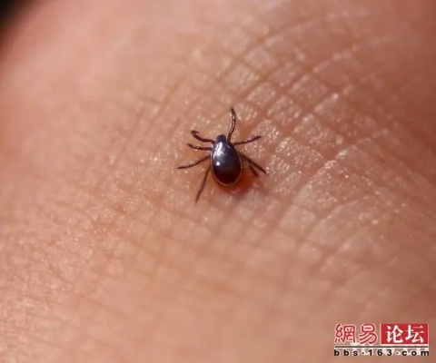 蜱虫河南郑州有吗? 蜱虫河南郑州有吗?