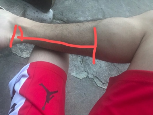我的跟腱长度决定了我的运动生涯:一个运动员的真实告白 我的跟腱长度决定了我的运动生涯:一个运动员的真实告白
