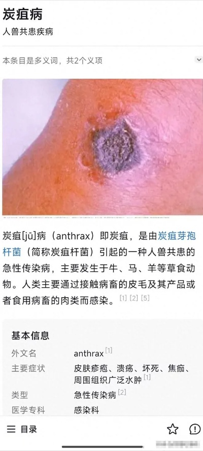 辽宁炭疽病:一位亲历者的血泪自述,那些被病痛撕裂的日子 辽宁炭疽病:一位亲历者的血泪自述,那些被病痛撕裂的日子