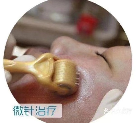 微针西安相关长尾关键词有哪些 微针西安相关长尾关键词有哪些